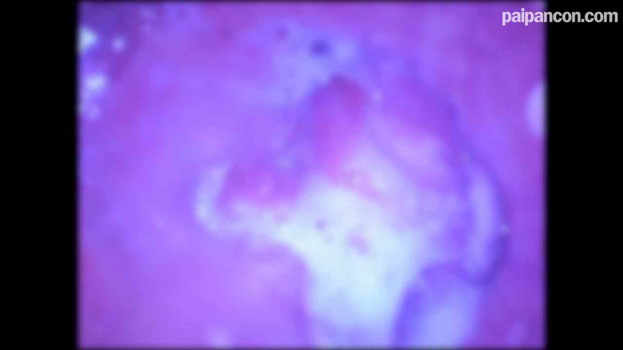 FC2-PPV-4625027 - ★特典で無修正と膣内カメラ ♀138 抜群なスレンダーBODYで顔もかわいいみさちゃんに、おじさんの子種をいっぱい注入♡ thumbnail_9.jpg